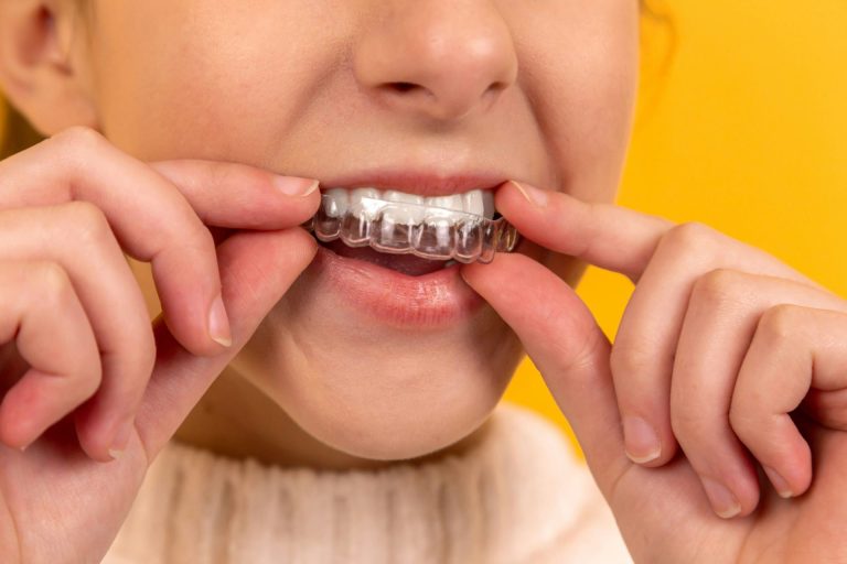 night guard for teeth clenching